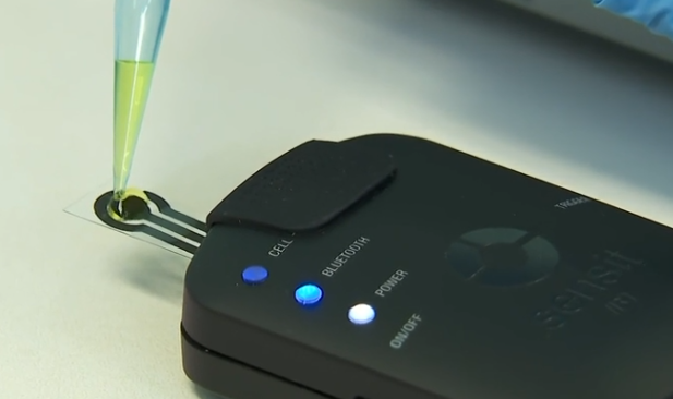 Teste de saliva desenvolvido por pesquisadores brasileiros pode ajudar no diagnóstico da depressão