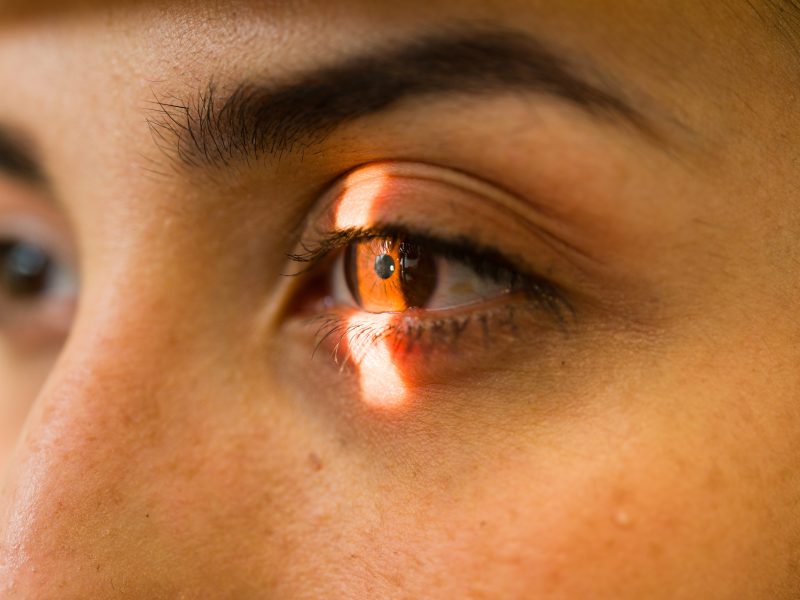 Abril Marrom 2026: campanha alerta para prevenção da cegueira e reforça importância de consultas oftalmológicas